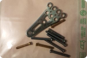 »Gewichtsoptimierung« abgeschlossen
